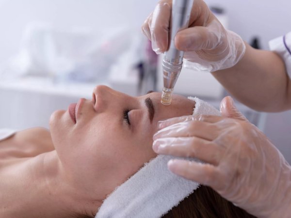 Mikrojehličková radiofrekvence: Omlazující procedura obličeje